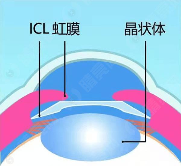 深圳技术好的近视眼手术医院排名前十,看深圳哪家近视眼手术好技术靠谱