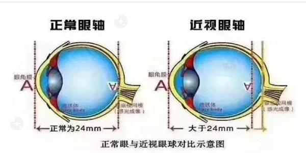 上海市未来视界儿童弱视近视防控优惠价格表，上海市价格惊人眼科医院。