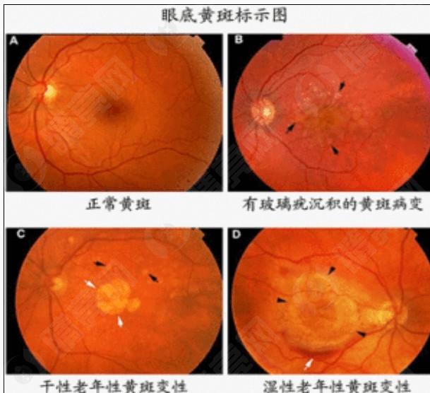 上海高清微飞秒C+有名的眼科医院排名 公布排名靠前的正规眼科医院
