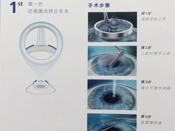我想知道怎么在家里测量自己的视力是否健康？