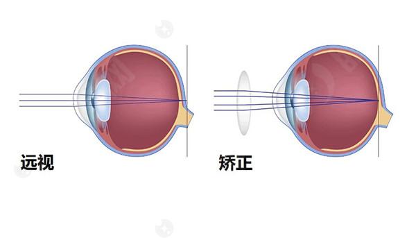 青岛眼科医院收费价目表
