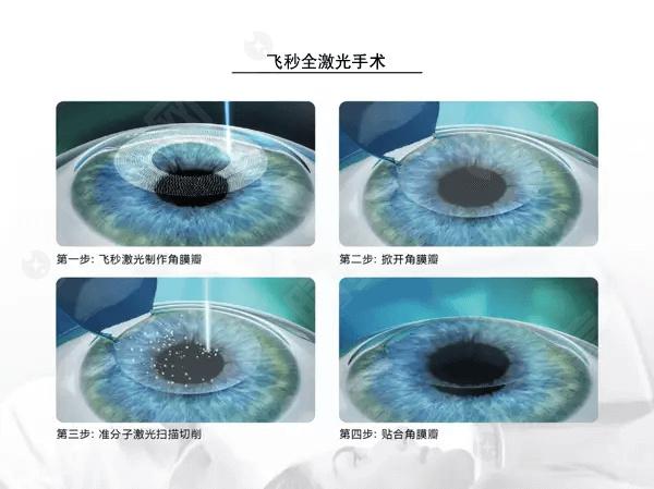2024年长沙老视手术实力排名榜单：正规且技术好的眼科都在此