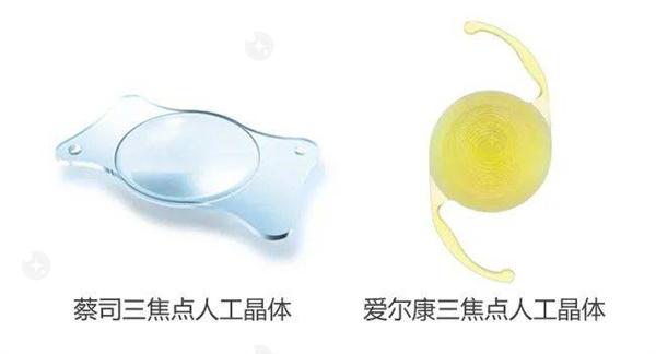 想知道沈阳老视手术收费价格，沈阳老视手术给力价格