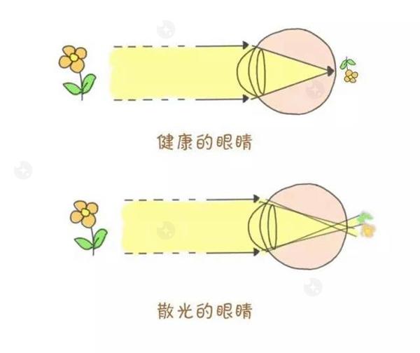 重庆白内障手术哪家好？集采后靠谱的十大眼科医院排行榜来喽