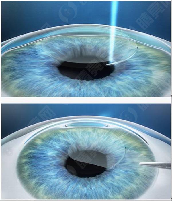 眼睛经常干涩，吃什么食物可能有助于改善干眼症？