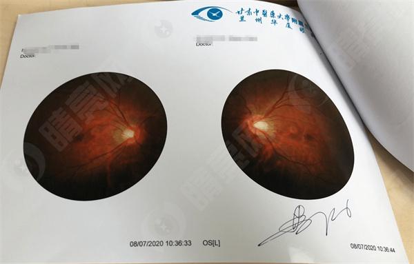 看看北京当兵晶体植入手术医院排名,总结北京近视眼手术医院都在这
