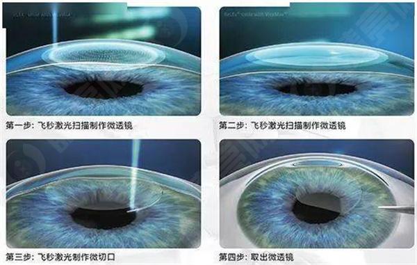 患有视力不佳的情况下，我能进入哪些工作环境或工厂就业？
