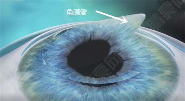 我近视度数越来越深，应该怎么办？