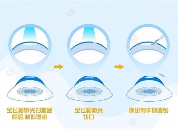 我近期发现在黑暗环境中看东西很困难，是不是夜盲症？这种症状有哪些表现？