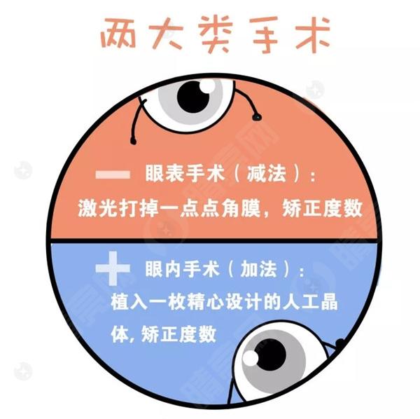 激光近视矫正结果如何？
