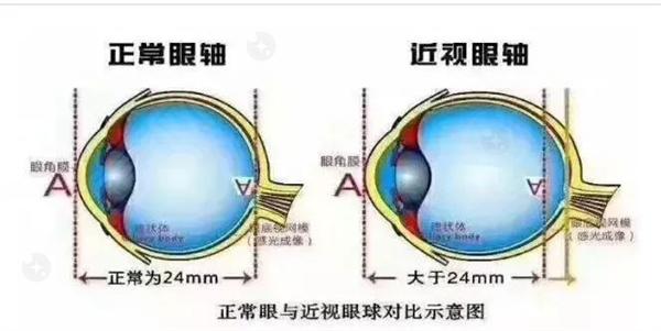 我近期得了结膜炎，这是否属于眼底病范畴？需要怎么治疗和预防呢？