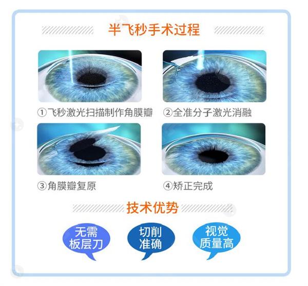 试问朝阳表层EK近视眼手术费用优惠吗，朝阳表层EK近视眼手术价格心水