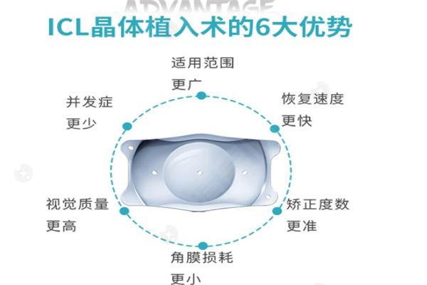 ICL晶体植入01.jpg