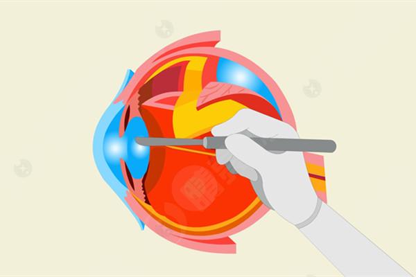 北京熙仁眼科医院值得信赖吗? 北京熙仁眼科医院值得信赖吗?