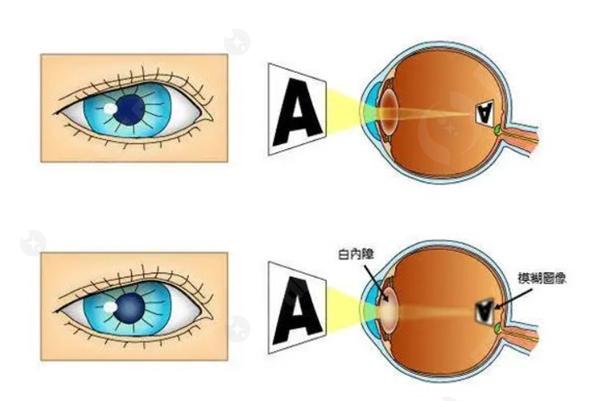 沈阳普瑞眼科营业时间+地址分享:正规眼科技术靠谱口碑好值得选择 沈阳普瑞眼科营业时间+地址分享:正规眼科技术靠谱口碑好值得选择