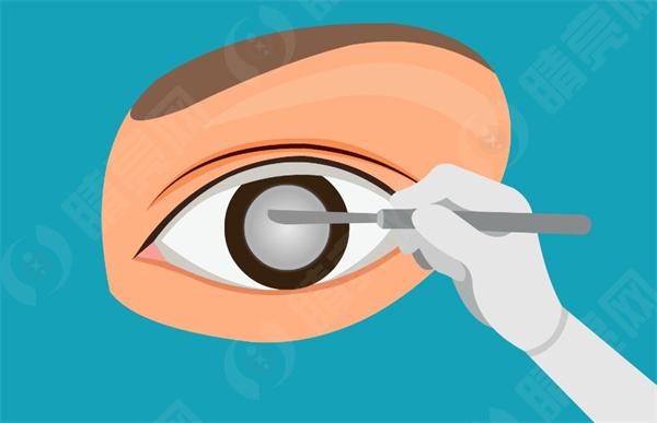 济南华厦眼科在哪个地铁站下?为你揭晓详细地址+便捷路线,让你轻松抵达眼科医院 济南华厦眼科在哪个地铁站下?为你揭晓详细地址+便捷路线,让你轻松抵达眼科医院