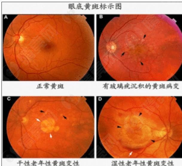 四川成都普瑞眼科医院口碑怎么样 看了医生介绍和口碑评价发现很靠谱