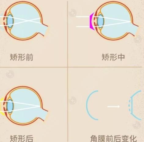 广州视百年眼科是不是正规的 本地人都说收费不贵且正规
