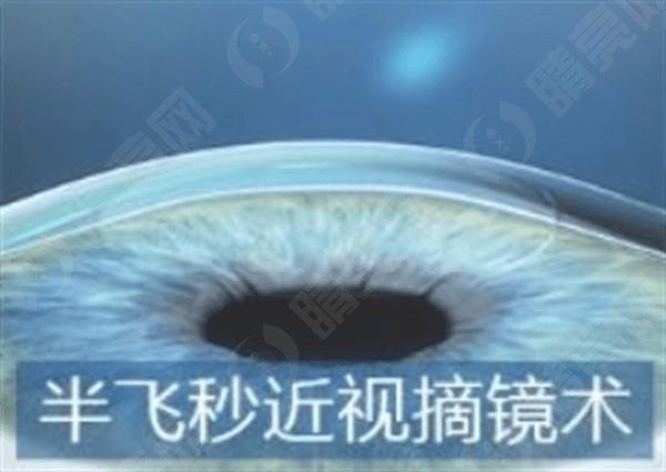 长沙博视眼科医院口碑怎么样 是正规的顾客口碑好价格不贵