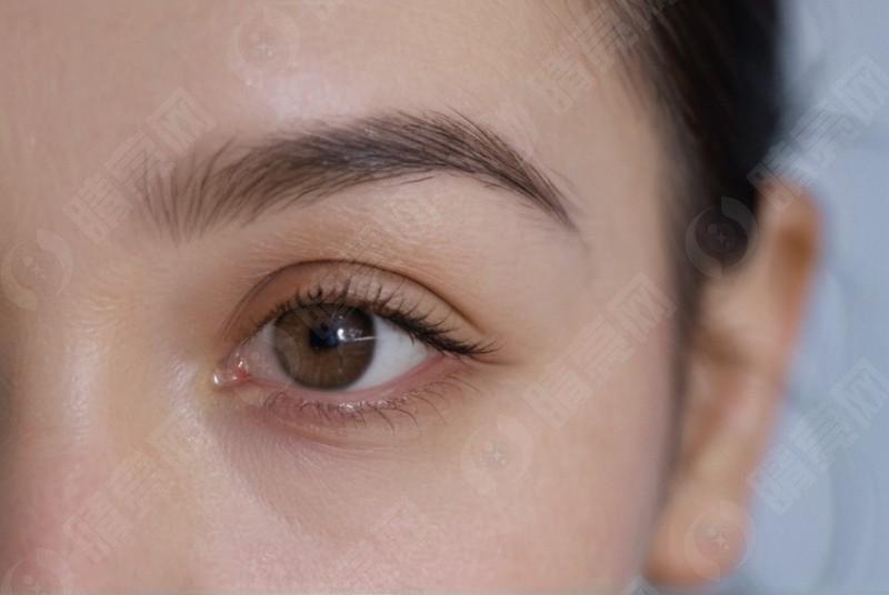 想知道广州眼科医院排名？这几家口碑好、技术强的医院值得关注！