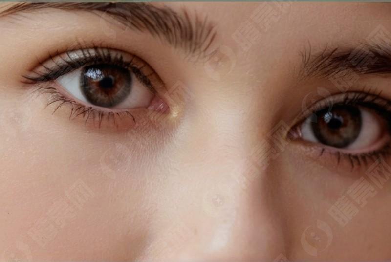 眼睛干涩总揉眼?可能是干眼症找上门 眼睛干涩总揉眼?可能是干眼症找上门