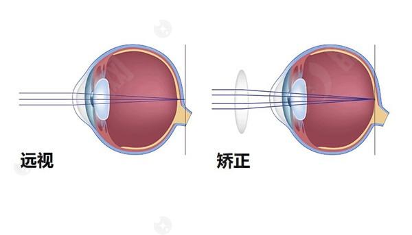 贵港爱眼眼科医院收费标准：瞧瞧斜视治疗 / 青光眼治疗价格多少