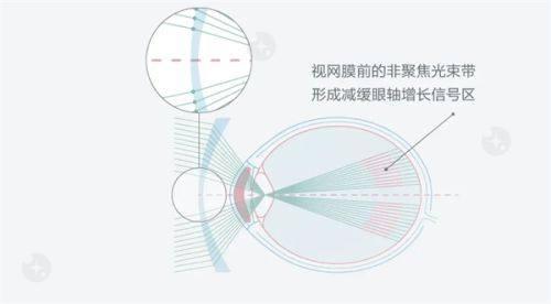 深圳爱尔眼科医院