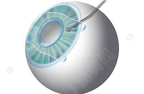 北京熙仁眼科医院值得信赖吗? 北京熙仁眼科医院值得信赖吗?