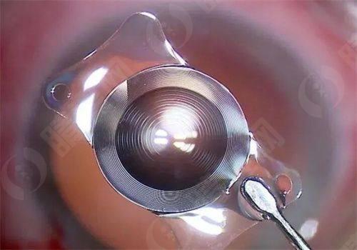 北京熙仁眼科医院的口腔诊疗服务体系