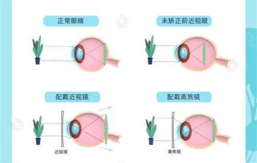 2026济南华厦眼科收费标准合理：半飞秒/全飞秒价格，让你放心看眼科！