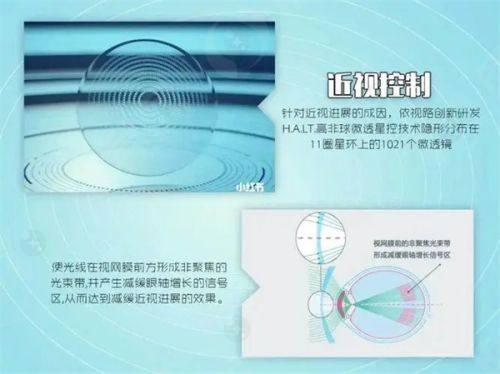 合肥普瑞眼科医院全飞秒激光微小切口基质透镜切除术价格与优势