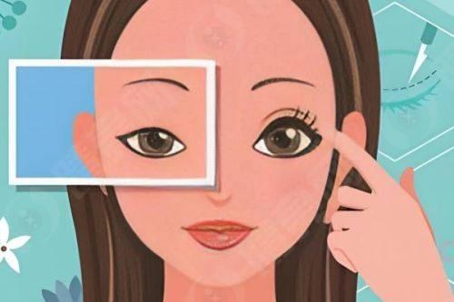 合肥普瑞眼科医院这俩手术性价比总结