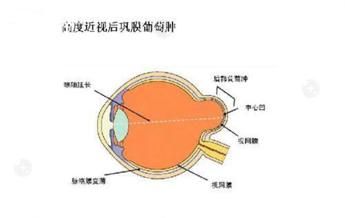 深圳博爱曙光眼科医院价格优势及服务特色